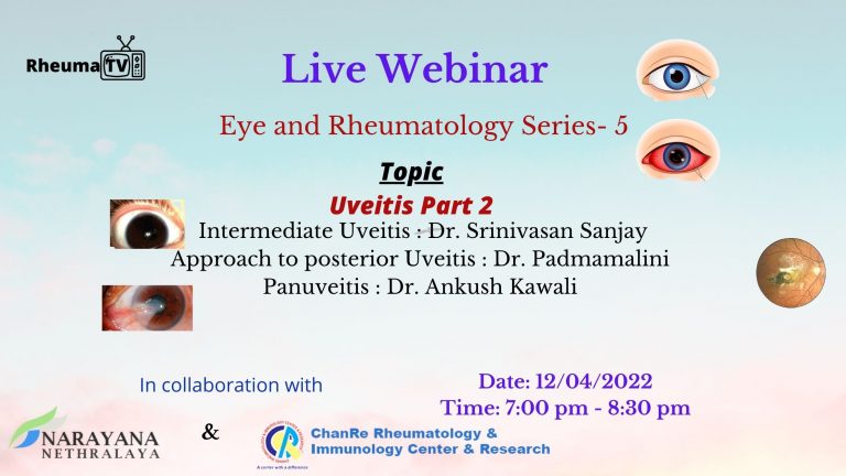 Eye and Rheumatology Series- 5  Uveitis Part 2