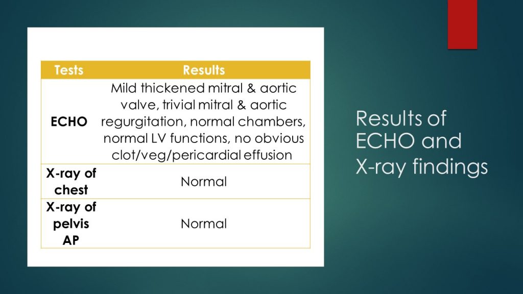 Results of ECHO and  X-ray findings