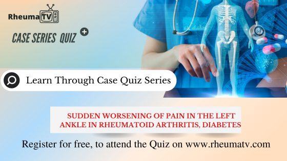 Sudden Worsening of Pain in the Left Ankle in Rheumatoid Arthritis, Diabetes