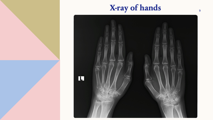X-ray of hands