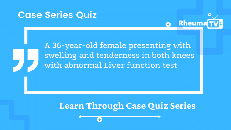 A 36-year-old female presenting with swelling and tenderness in both the knees with abnormal Liver function test 