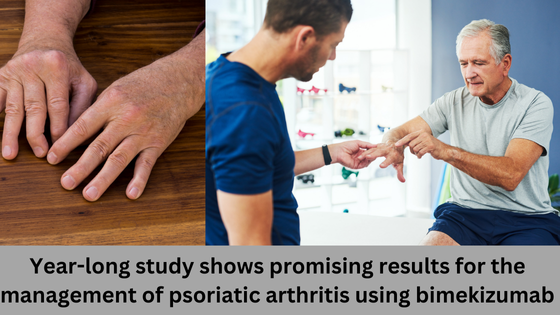 Year-long study shows promising results for the management of psoriatic arthritis using bimekizumab