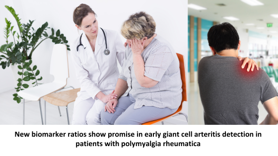 New biomarker ratios show promise in early giant cell arteritis detection in patients with polymyalgia rheumatica