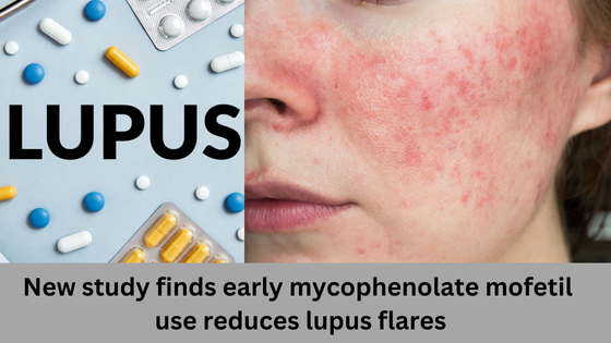 New study finds early mycophenolate mofetil use reduces lupus flares