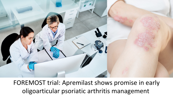 FOREMOST trial: Apremilast shows promise in early oligoarticular psoriatic arthritis management