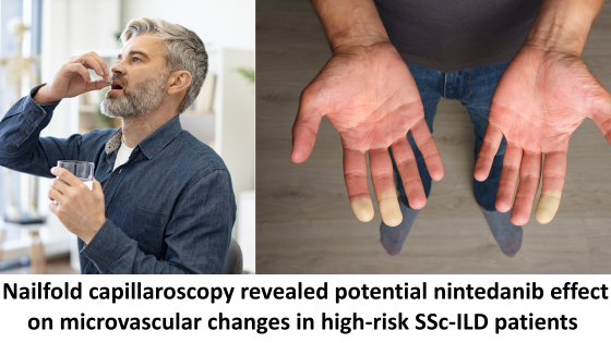 Nailfold capillaroscopy revealed potential nintedanib effect on microvascular changes in high-risk SSc-ILD patients